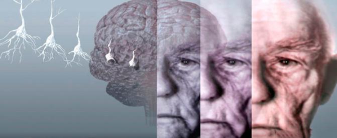 چگونه می توان خطر ابتلا به آلزایمر را کاهش داد؟